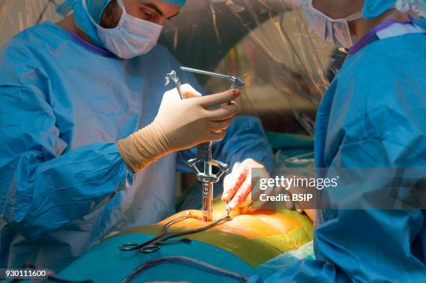 Orthopedic operating theatre, Pasteur 2 Hospital, Nice, France, Medullary liberation and arthrodesis, patient suffering from lumbar stenosis caused...
