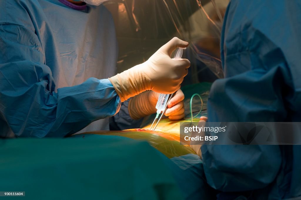 Spine Surgery