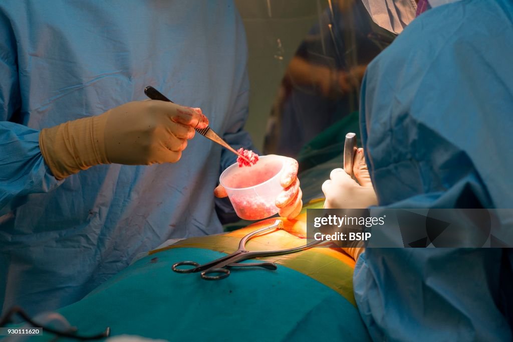 Spine Surgery