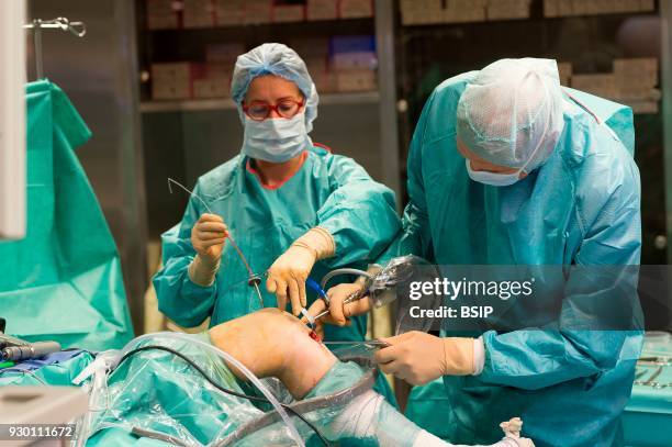Orthopedic surgery, Saint George Clinic, Nice, France, Treating a torn cruciate ligament using the Sambba technique, carried out under arthroscopy,...