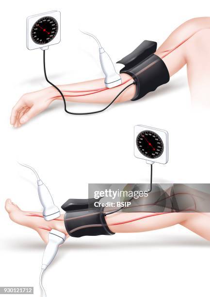Brachial Artery Stock Photos Photos And Premium High Res Pictures brachial-artery-stock-photos-photos-and-premium-high-res-pictures