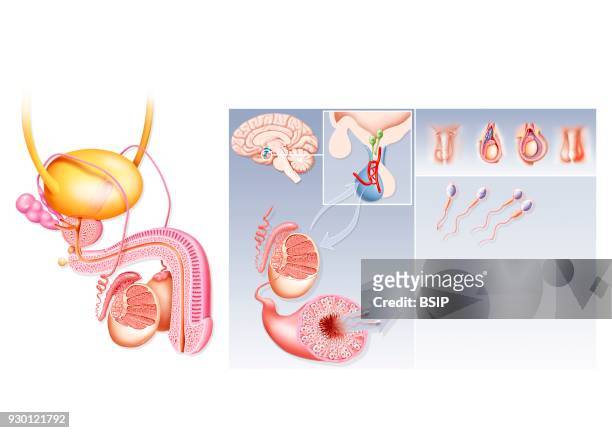 Illustration of the causes of male infertility. On the left, illustration of the male genital organs. In the center, illustration of the...