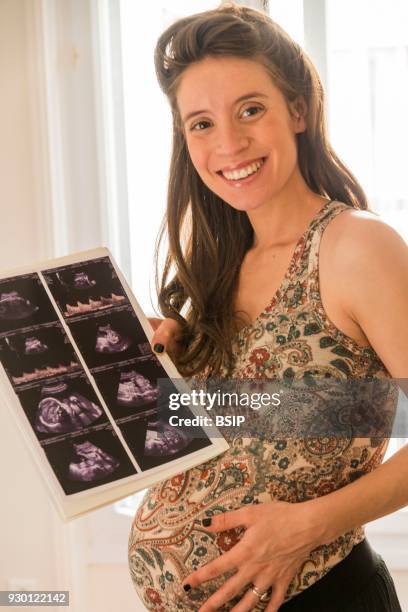 Pregnant woman holding an ultrasound scan.