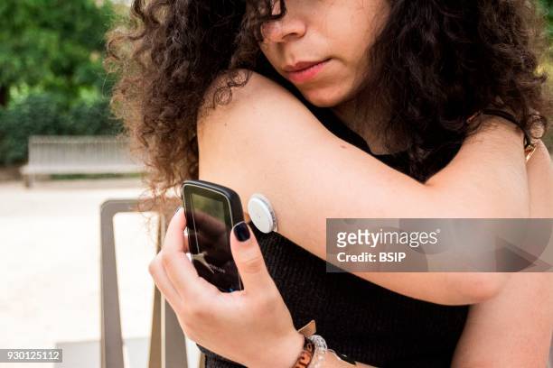Diabetic teen equipped with glucose sensor and Freestyle Libre scanner which can just be flashed at the sensor on the back of arm to instantly...