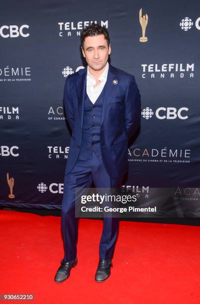 Allan Hawco arrives at the 2018 Canadian Screen Awards at the Sony Centre for the Performing Arts on March 11, 2018 in Toronto, Canada.