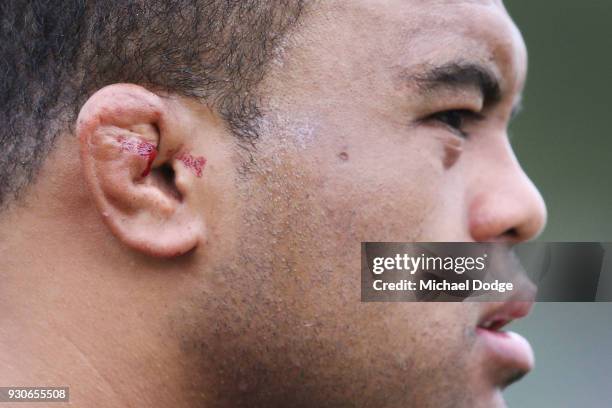 Cauliflower Ear Exploding Cauliflower Ears Photos and Premium High Res Pictures - Getty Images