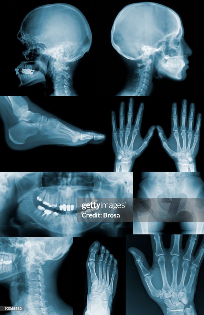 Useful X-Ray images