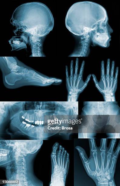 useful x-ray images - male crotch stock pictures, royalty-free photos & images