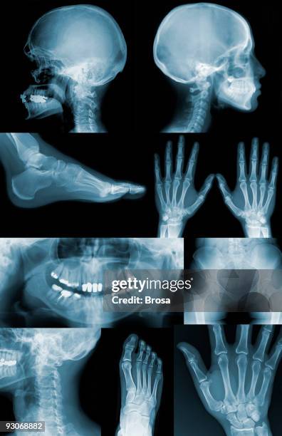 useful x-ray images - human back stock pictures, royalty-free photos & images