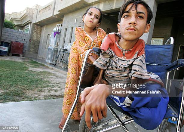 Anas Hamed and his sister Inas who suffer from birth defects are pictured on November 12, 2009 in the city of Falluja west of Baghdad, Iraq. Birth...