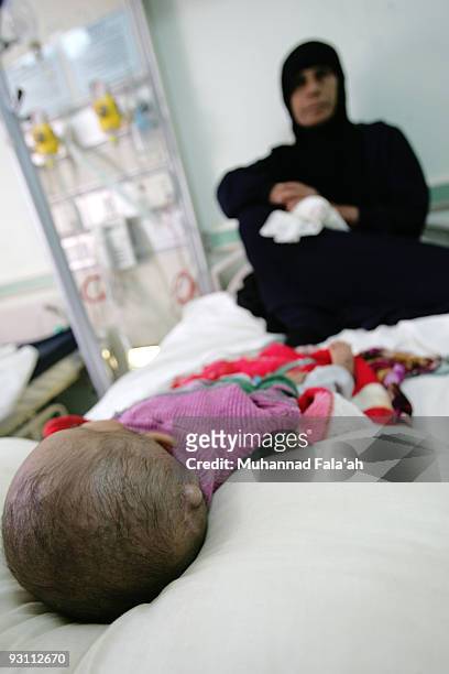 An Iraqi child suffering from a birth defect is pictured with his mother on November 12, 2009 at Falluja General Hospital in the city of Falluja west...