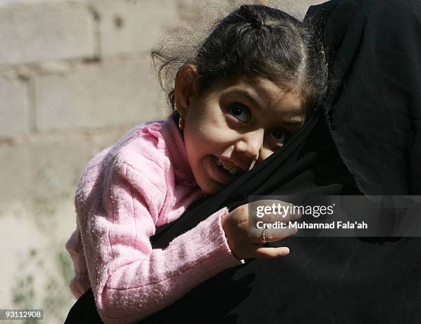 Mariam Yasir , age 6 years old, who suffers from a birth defect, cries as her mother carries her on November 12, 2009 in the city of Falluja west of...