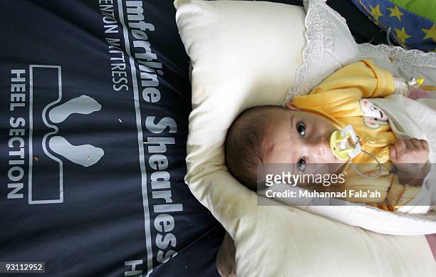Sick Iraqi child is pictured at Falluja General Hospital on November 12, 2009 in the city of Falluja west of Baghdad, Iraq. Birth defects have soared...