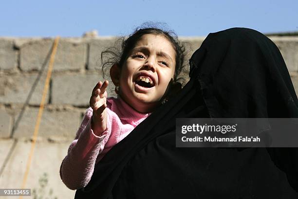 Mariam Yasir , age 6 years old, who suffers from a birth defect, cries as her mother carries her on November 12, 2009 in the city of Falluja west of...