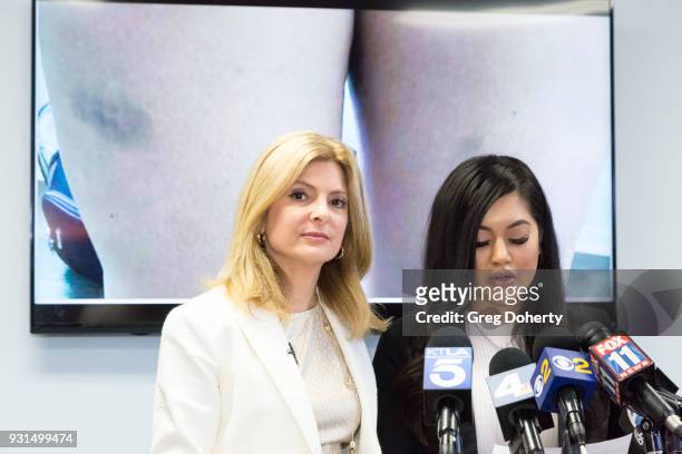 Andrea Buera , who is accusing Trey Songz of assaulting her, speaks during a press conference with her attorney Lisa Bloom at The Bloom Firm on March...
