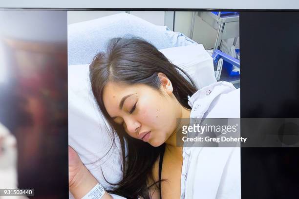 Monitor displays images of Andrea Buera with injuries allegedly caused by Trey Songz, during a press conference with Buera's attorney Lisa Bloom...