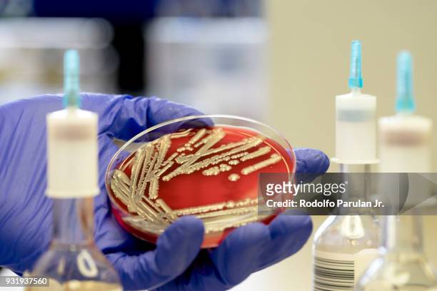 escherichia coli (e. coli) colonies - escherichia coli stock-fotos und bilder