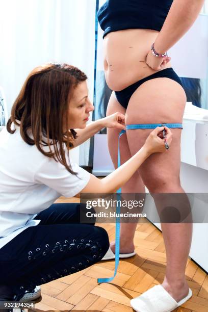 woman using measuring tape to assess leg volume - woman with thick legs imagens e fotografias de stock