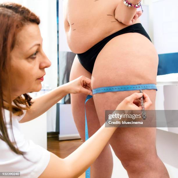 woman using measuring tape to assess leg volume - thigh human leg imagens e fotografias de stock