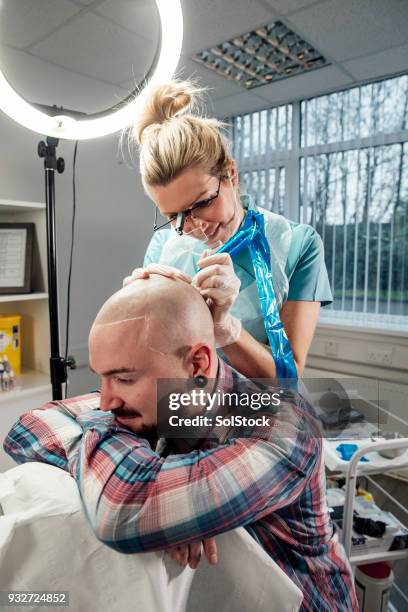 receiving scalp micro-pigmentation - human scalp stock pictures, royalty-free photos & images