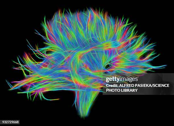 white matter fibres of the human brain, dsi scan - nerve fiber stock pictures, royalty-free photos & images