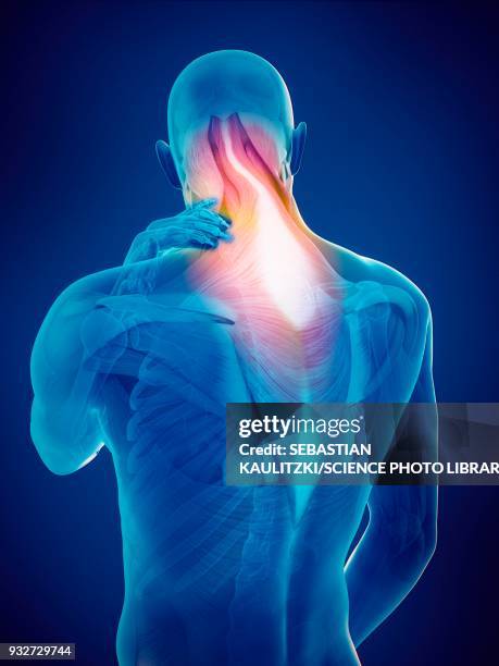 person with neck pain, illustration - neck muscle pain illustration stock illustrations