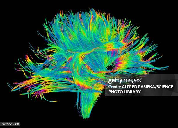 white matter fibres of the human brain, dsi scan - human brain mri stock pictures, royalty-free photos & images