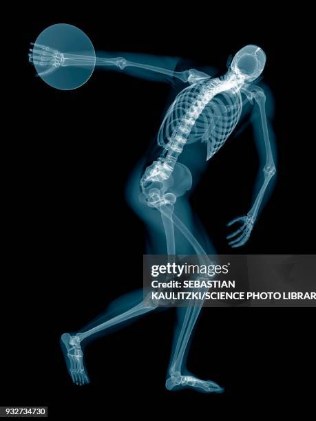 Discus Injuries Illustration Athlete Anatomy Photos and Premium High Res Pictures ...