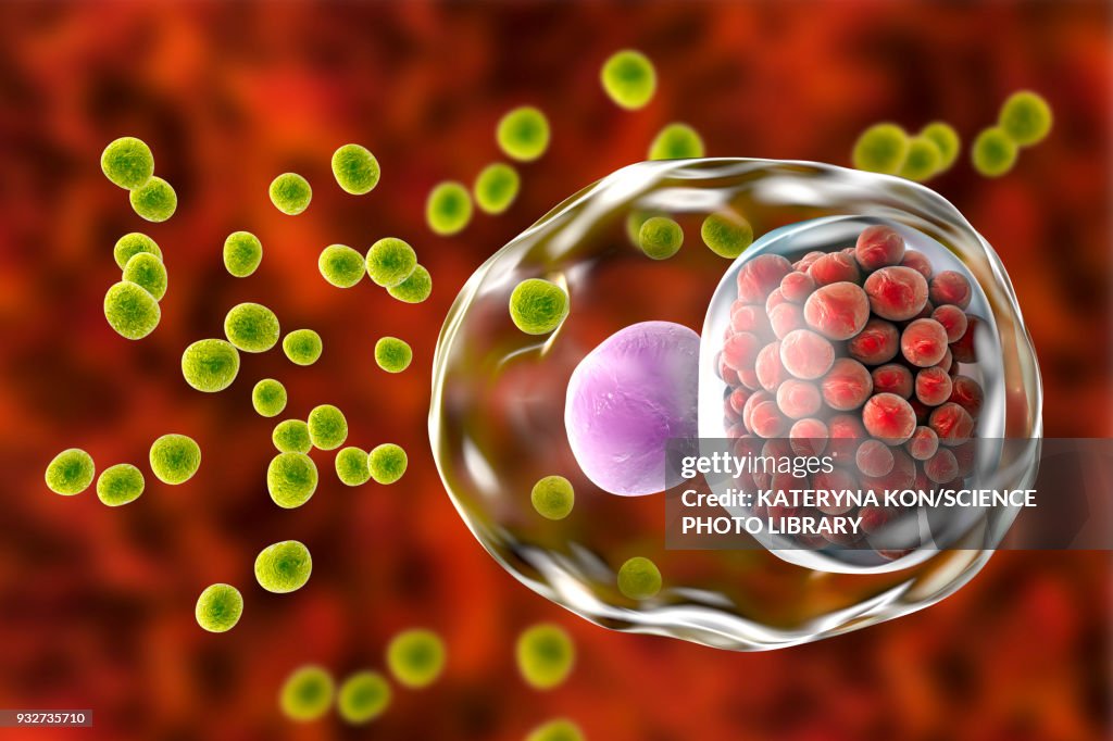 Chlamydia infection, illustration