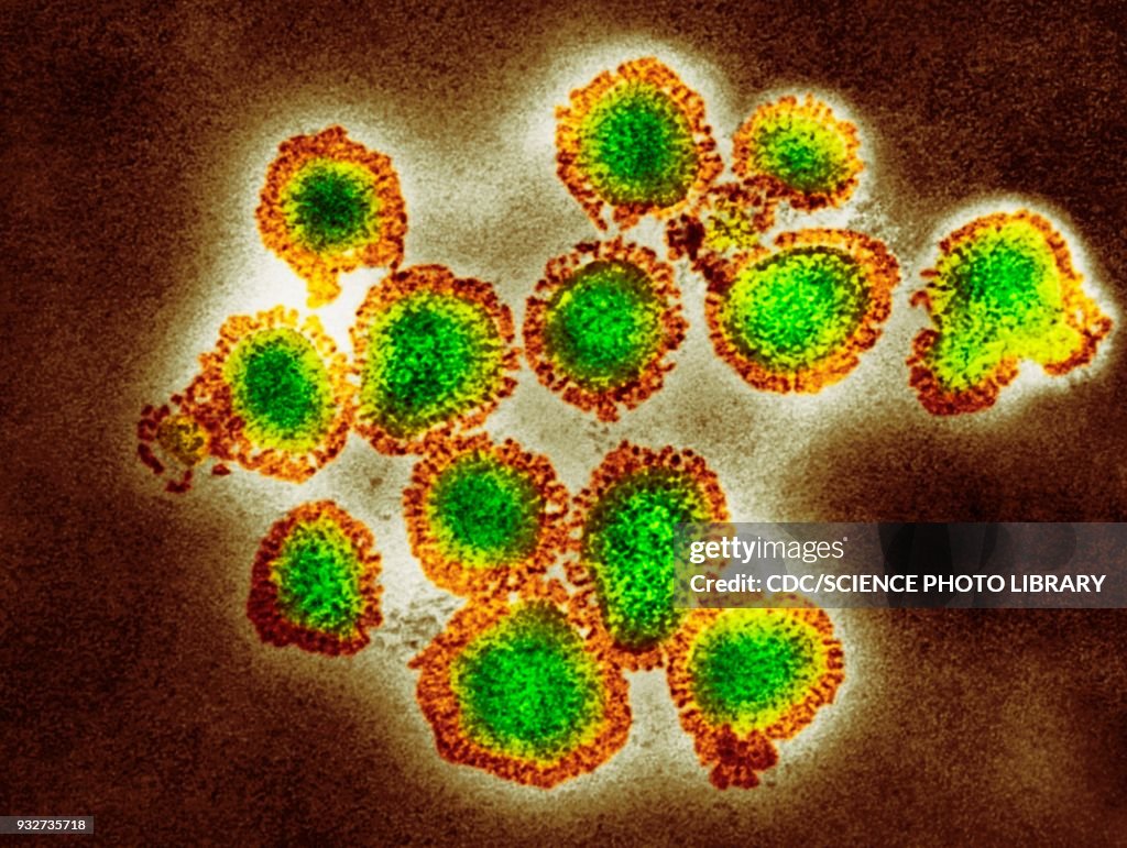 H3N2 influenza virus particles, TEM