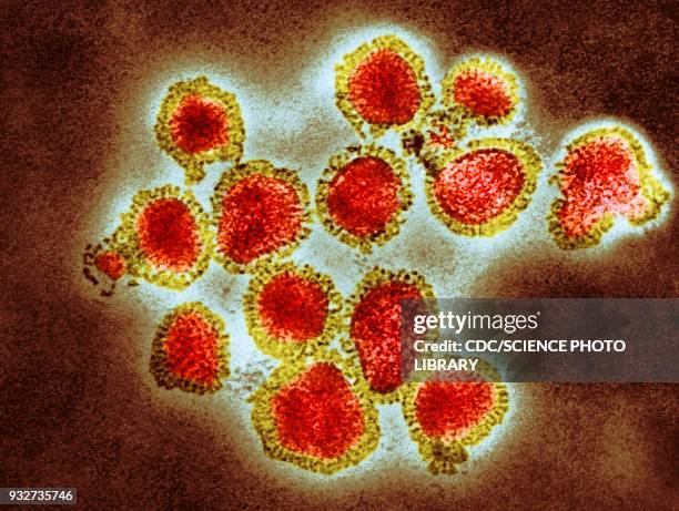 h3n2 influenza virus particles, tem - h3n2 stock-fotos und bilder