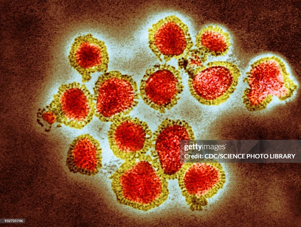 H3N2 influenza virus particles, TEM
