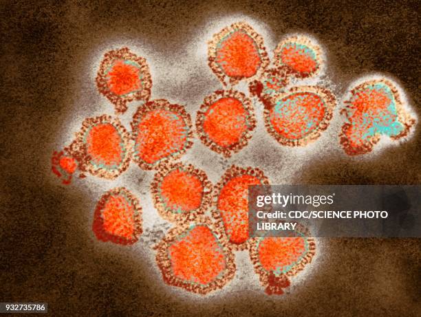 h3n2 influenza virus particles, tem - h3n2 stock-fotos und bilder