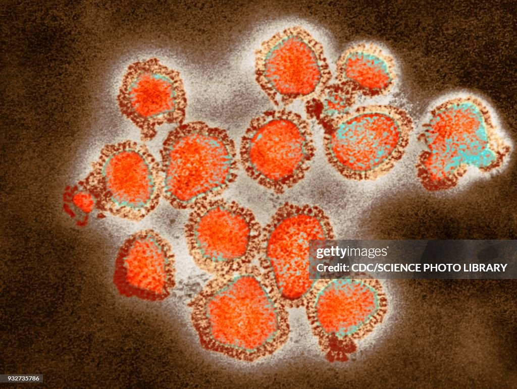H3N2 influenza virus particles, TEM