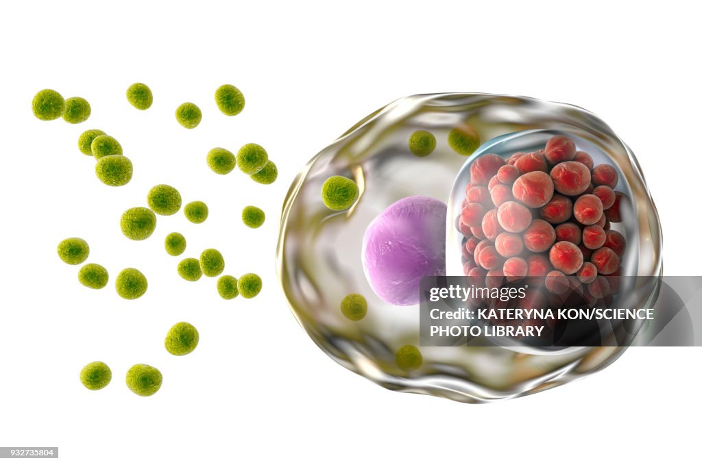 Chlamydia infection, illustration
