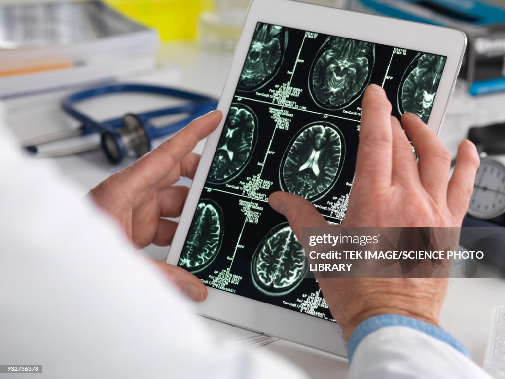 Doctor viewing brain scans