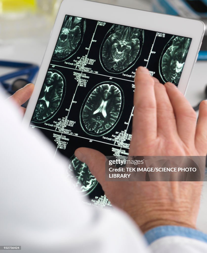 Doctor viewing brain scans