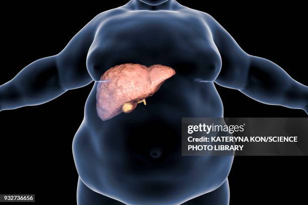 fatty liver in obese person, conceptual illustration - menschliche leber stock-grafiken, -clipart, -cartoons und -symbole