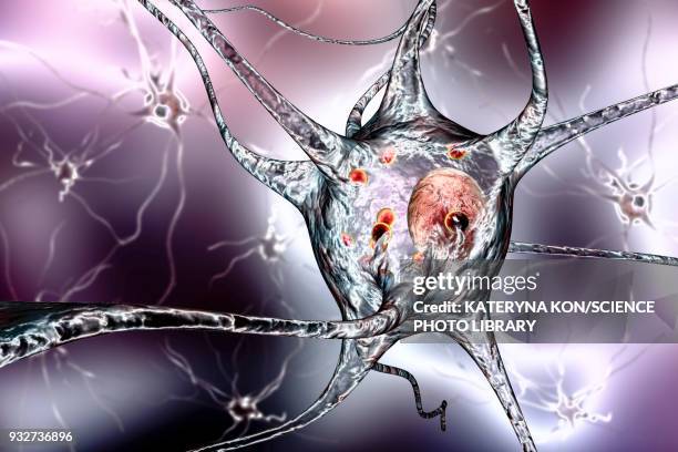 parkinsons disease nerve cells, illustration - parkinsons disease stock illustrations