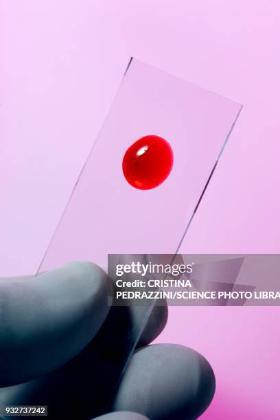 blood sample on microscope slide - lâmina-de-microscópio - fotografias e filmes do acervo