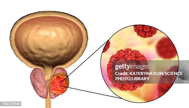 viral etiology of prostate cancer, conceptual illustration - exocrine gland stock illustrations