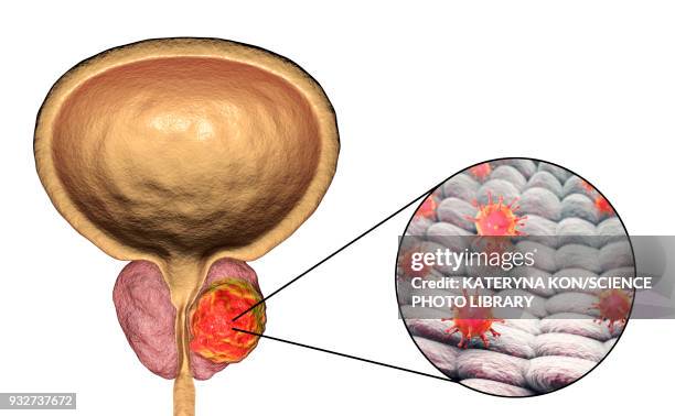 viral etiology of prostate cancer, conceptual illustration - exocrine gland stock illustrations