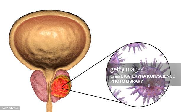 viral etiology of prostate cancer, conceptual illustration - exocrine gland stock illustrations