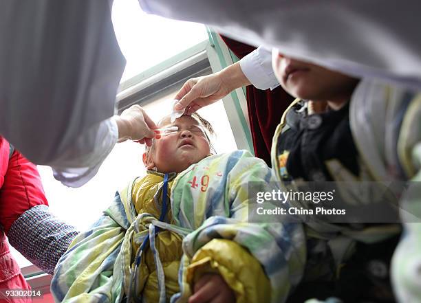 Doctor applies eyedrops for a four-year-old girl who has undergone cataract surgery by the Lifeline Express in a hospital on November 22, 2009 in...