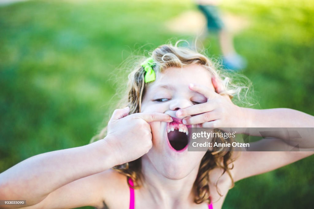 Girl Showing off Missing Tooth