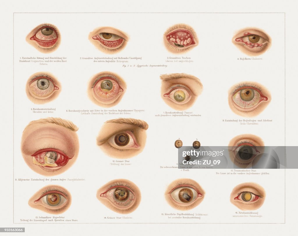 Doenças oculares, litografia, publicadas em 1897