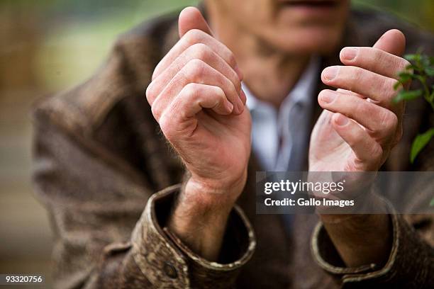 Pardoned SA mercenary Niek du Toit shows the marks where handcuffs cut to the bone during his imprisonment in Equatorial Guinea in an interview with...