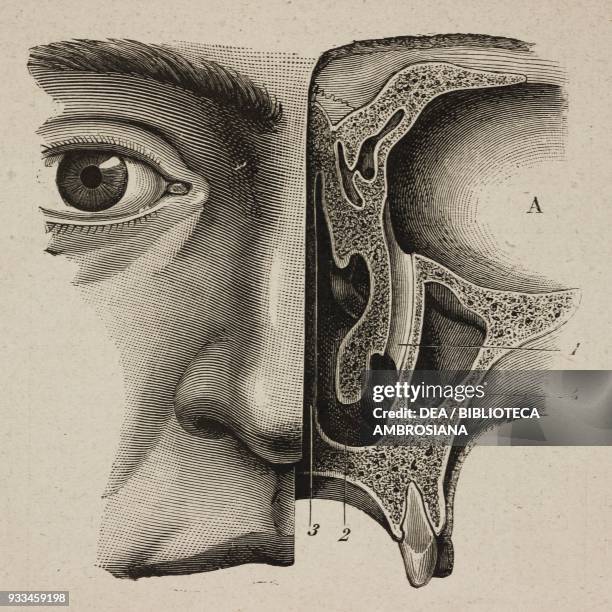 Section of facial bones showing the eye socket the lachrymal sac , the nasal passage , the partition of the nasal passages and the maxillary sinus ,...