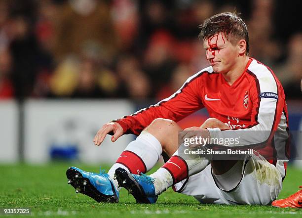 Andrei Arshavin of Arsenal leaks blood from a head injury during the UEFA Champions League group H match between Arsenal and Standard Liege at...