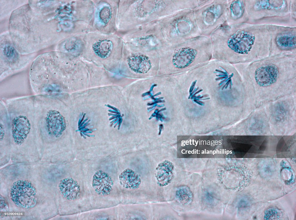 Microscope image of plant cells stained for nuclei